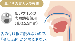 鼻からの胃カメラ検査